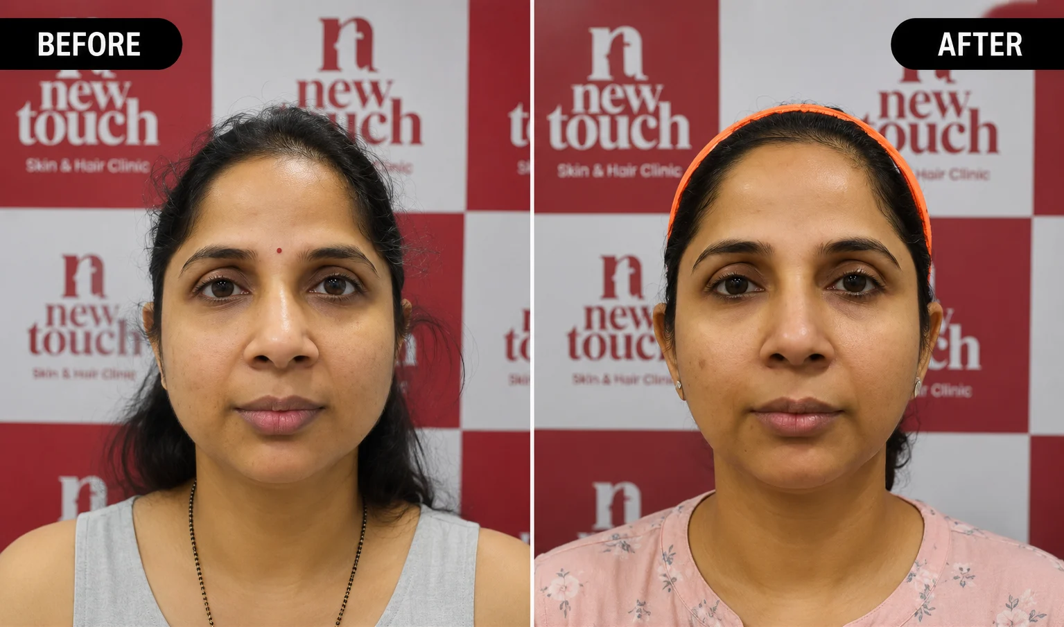 Before and after treatment