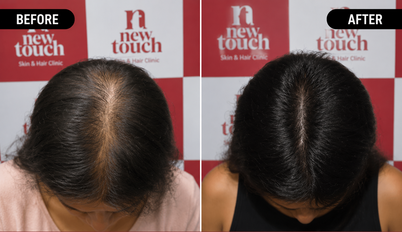 Treatment Results