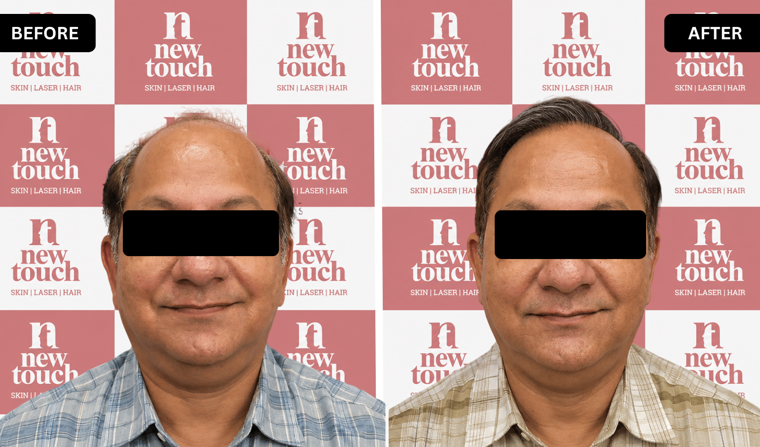 Treatment Result