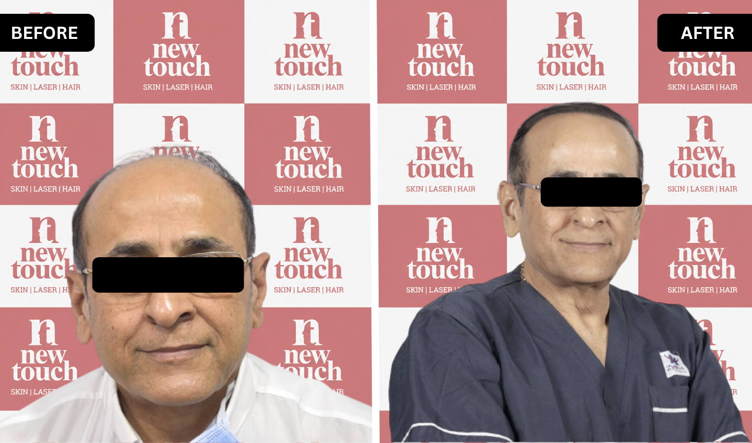 Treatment Result