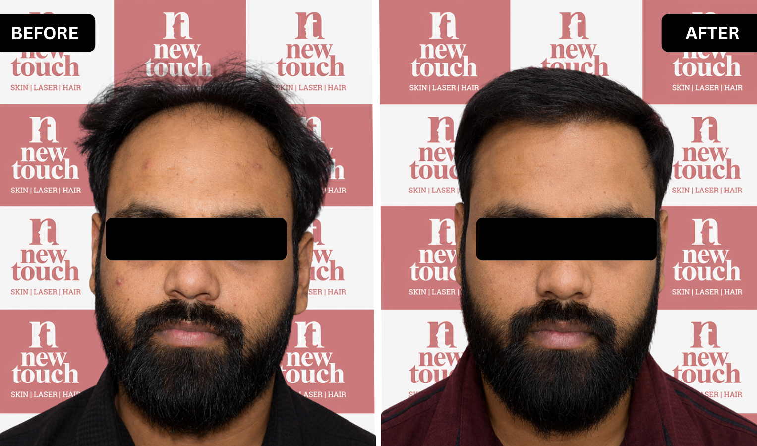 Treatment Result