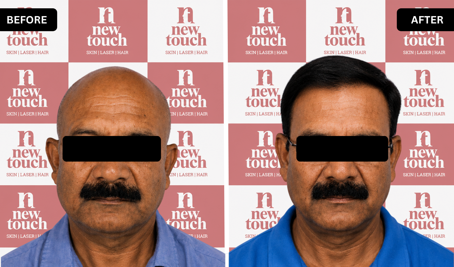 Treatment Result