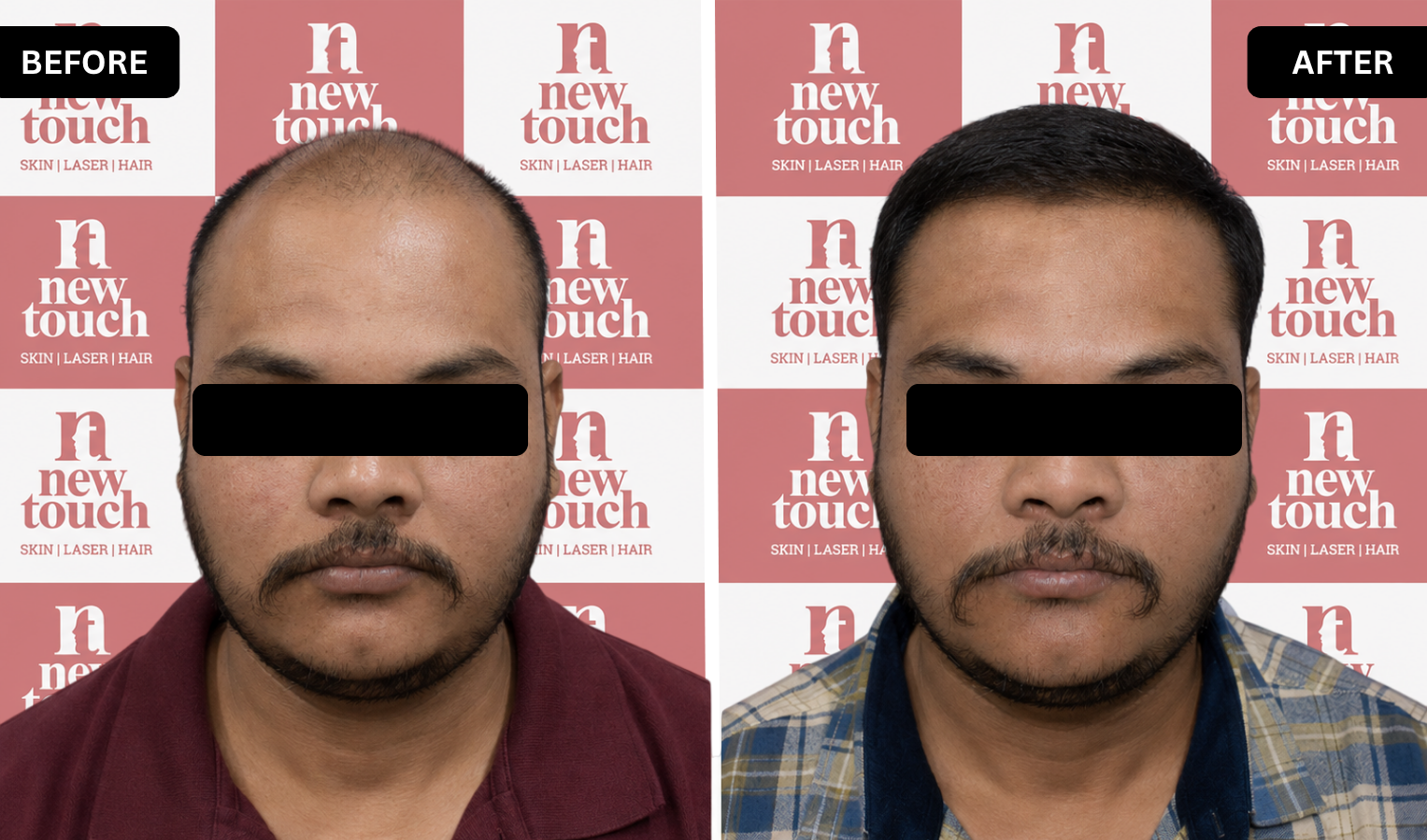 Treatment Result
