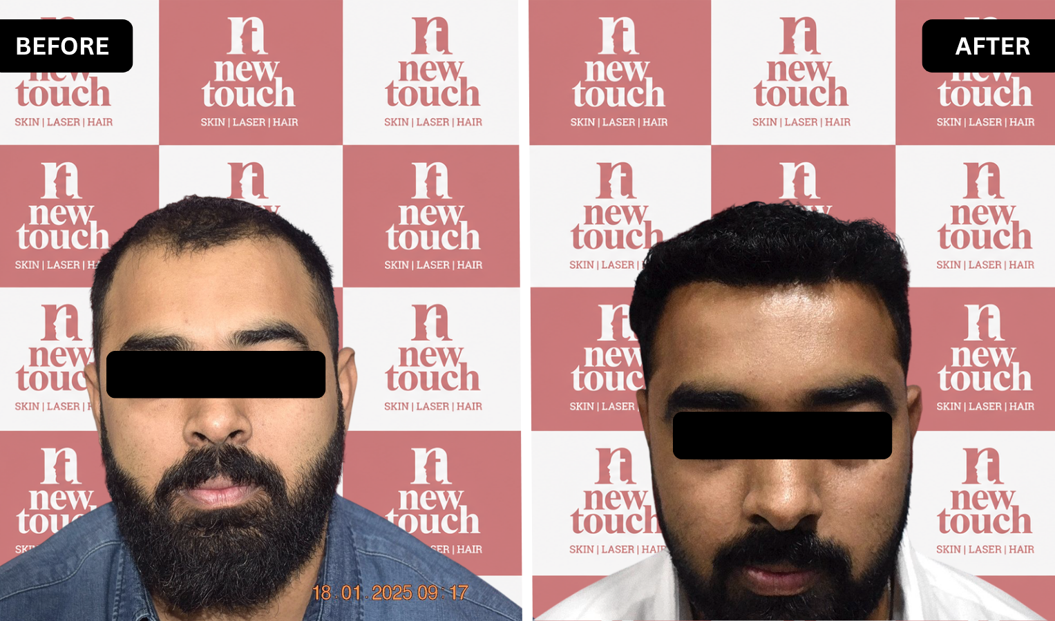 Treatment Result