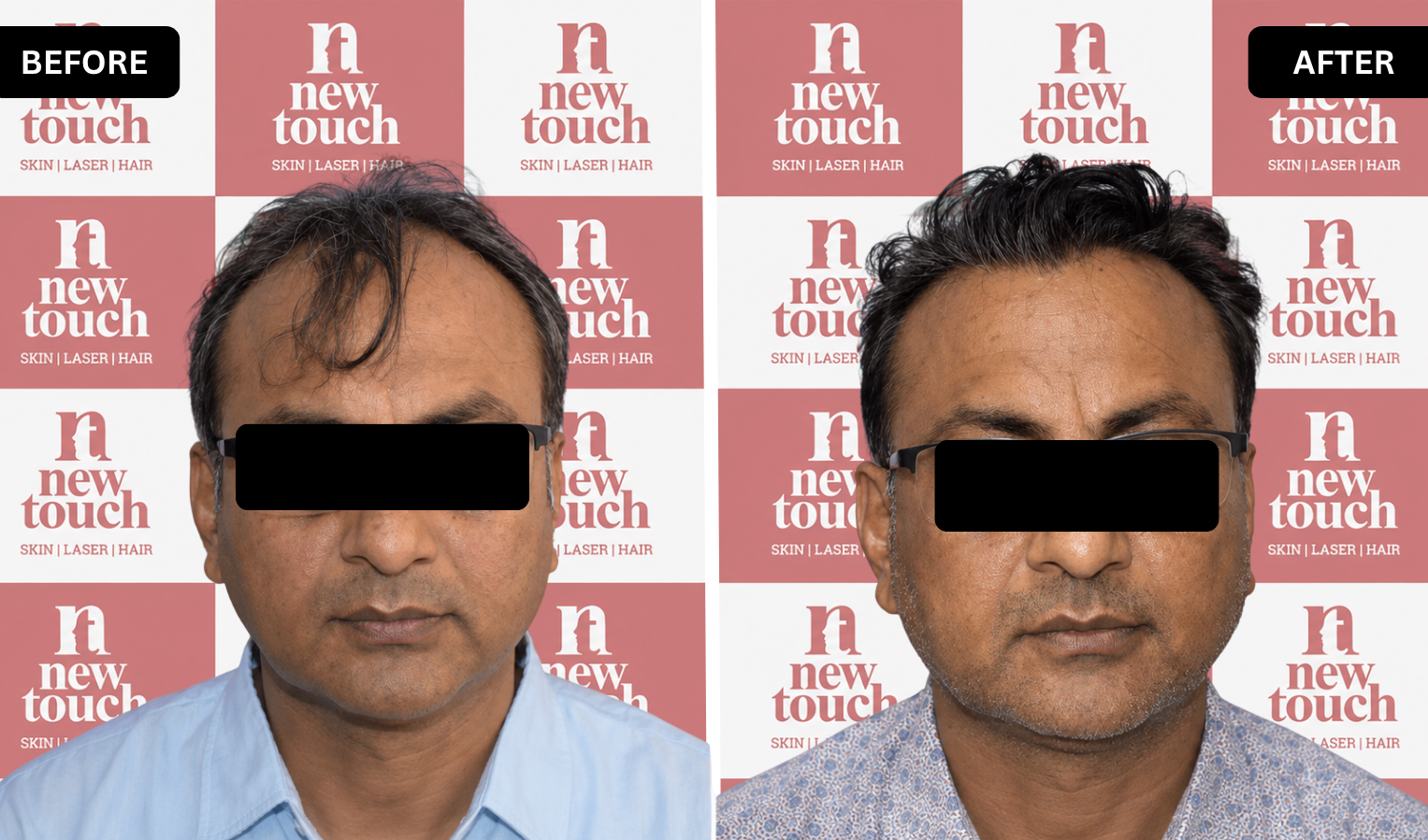 Treatment Result