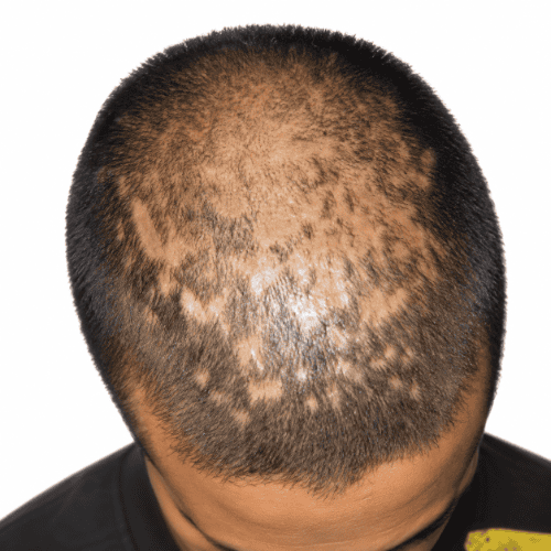 Treatment Results